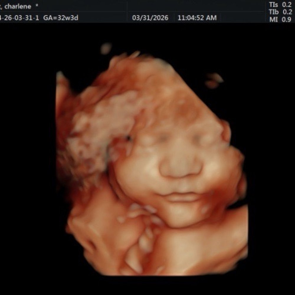 Baby’s First Glance - Ultrasound Imaging Centers Near Me - San Jose, California Baby’s First Glance - Ultrasound Imaging Centers Near Me - San Jose, California