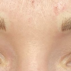 Angel Skin and Wax Studio - After micro blading