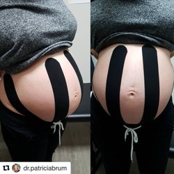 Hudson Integrative Healthcare - Reducing pregnancy-related back pain with adjustment & taping by Dr. Patricia Brum