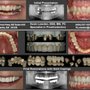 Photo of Atlanta Dental Restorative Specialist