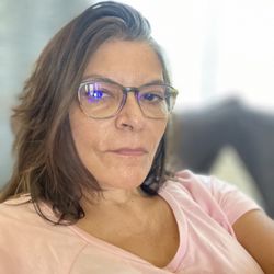 Michelle Cabret, MD DDS - Still a little tight & swollen but happy with results.