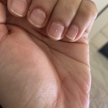DMG Nails - Ruined nail beds - Nail Salons Near Me - Livonia, Michigan