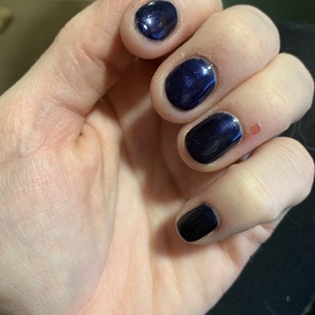 Club Nails - The skin issues around my nails is from me biting them , not from the manicure - Nail Salons Near Me - Port Reading, New Jersey Club Nails - The skin issues around my nails is from me biting them , not from the manicure - Nail Salons Near Me - Port Reading, New Jersey