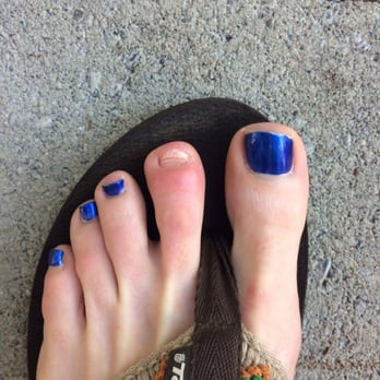Peony Nails & Spa - Infected toe after receiving a pedicure here. My nail actually fell off about two weeks after visiting this salon. - Nail Salons Near Me - Seattle, Washington Peony Nails & Spa - Infected toe after receiving a pedicure here. My nail actually fell off about two weeks after visiting this salon. - Nail Salons Near Me - Seattle, Washington
