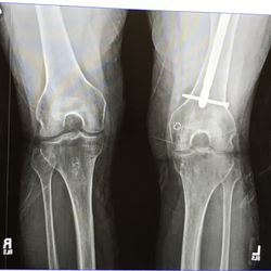 Golden State Orthopedics & Spine Physical Therapy - Oakland