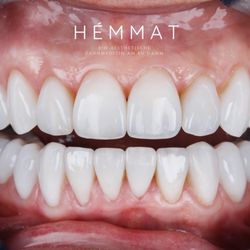 HÉMMAT BIO-AESTHETICS - Flowable Injection by Dr. Hémmat