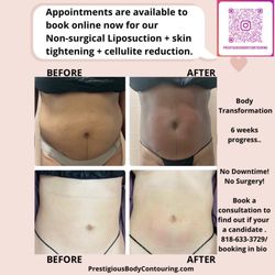 Prestigious Body Contouring
