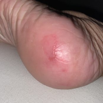 Classic Nails & Spa - Beware of the cheese grater callus remover! - Nail Salons Near Me - Peoria, Arizona