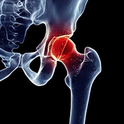 Signature Orthopedics: Obi Osuji, MD, FAAOS
