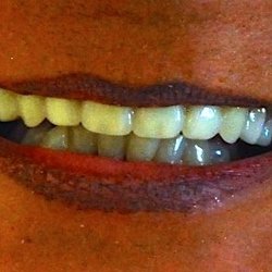 Chips Dental Associates - Gibsonia