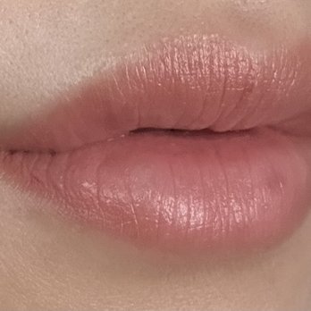 TN Esthetics Center - Fuller and plump lips. Natural Korean lips injection from our esthetics nurse. - Eyelash Service Near Me - Cerritos, California TN Esthetics Center - Fuller and plump lips. Natural Korean lips injection from our esthetics nurse. - Eyelash Service Near Me - Cerritos, California