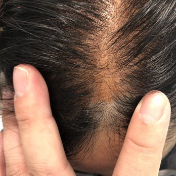 Salon Rouge - Toned my whole scalp red! I had a date that night too... - Hair Salons Near Me - Ottawa, Ontario Salon Rouge - Toned my whole scalp red! I had a date that night too... - Hair Salons Near Me - Ottawa, Ontario