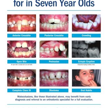 Craig and Streight Orthodontics - Norman - We recommend children see an Orthodontist at age 7 so that we can monitor their growth and catch problems early - Orthodontists Near Me - Norman, Oklahoma Craig and Streight Orthodontics - Norman - We recommend children see an Orthodontist at age 7 so that we can monitor their growth and catch problems early - Orthodontists Near Me - Norman, Oklahoma