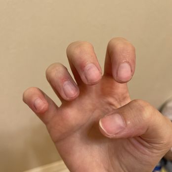 Venezia Nail Spa - Day after. Cuticles we're all cut and swollen. The dent at the top by my cuticles was from her - my nexgen was more grown out than that. - Nail Salons Near Me - Prosper, Texas Venezia Nail Spa - Day after. Cuticles we're all cut and swollen. The dent at the top by my cuticles was from her - my nexgen was more grown out than that. - Nail Salons Near Me - Prosper, Texas