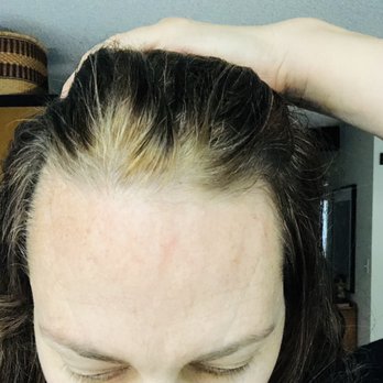 Studio 210 Brentwood - splotchy area up front where roots were left yellow, makes me look like I have a receding hairline.... - Hair Salons Near Me - Los Angeles, California Studio 210 Brentwood - splotchy area up front where roots were left yellow, makes me look like I have a receding hairline.... - Hair Salons Near Me - Los Angeles, California