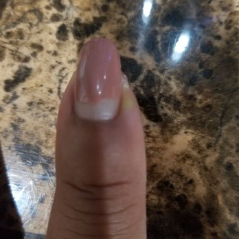Asia Nails Salon - Nail infection from this salon! - Nail Salons Near Me - Chicago, Illinois Asia Nails Salon - Nail infection from this salon! - Nail Salons Near Me - Chicago, Illinois