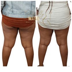 Gliterally Magic Body Sculpting