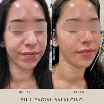 Balance Lab Aesthetics - Medical Spas Near Me - La Habra, California Balance Lab Aesthetics - Medical Spas Near Me - La Habra, California