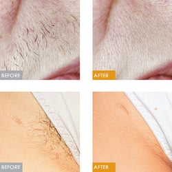 Northampton Laser Clinic