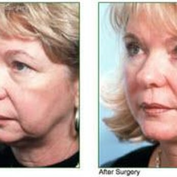 Roger A Allcroft, MD FACS - Plastic Surgeons Near Me - Northampton, Massachusetts Roger A Allcroft, MD FACS - Plastic Surgeons Near Me - Northampton, Massachusetts