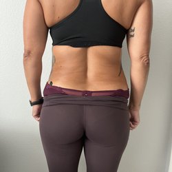 META Beauty & Body Sculpting