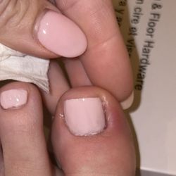 Bliss Nails & Spa - My whole toe is painful red and swollen