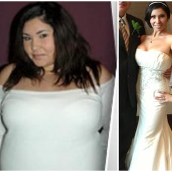 Michael Feiz, MD - Dr. Feiz patient who had Lap Band lost over 100 lbs! - Weight Loss Centers Near Me - Santa Clarita, California Michael Feiz, MD - Dr. Feiz patient who had Lap Band lost over 100 lbs! - Weight Loss Centers Near Me - Santa Clarita, California