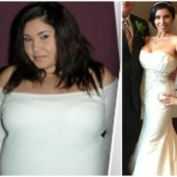 Michael Feiz, MD - Dr. Feiz patient who had Lap Band lost over 100 lbs!