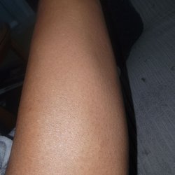 Spirit Halloween - Leg burn