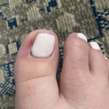 Eden Nails - Skin ripped off from electric sander 1 day after service - Nail Salons Near Me - Aberdeen Township, New Jersey