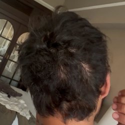 Hovel - Aqui se ve lo disparejo que quedo y como se ven hasta espacios sin pelo.