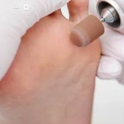 Pedi Care - Pedi médico