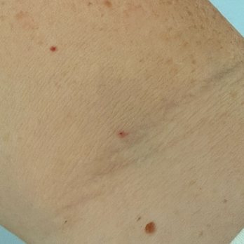 Labcorp at Walgreens - Today by the Hispanic gentleman. - Laboratory Testing Near Me - Eastvale, California Labcorp at Walgreens - Today by the Hispanic gentleman. - Laboratory Testing Near Me - Eastvale, California