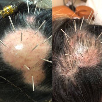 Beverly Hill Integrative Medicine Group - Acupuncture Near Me - Beverly Hills, California