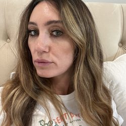 Eos Rejuvenation - After pic