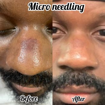 Bellissimo You - "Bellissimo You" call for a consult today. (813)766-0119 - Skin Care Near Me - Tampa, Florida Bellissimo You - "Bellissimo You" call for a consult today. (813)766-0119 - Skin Care Near Me - Tampa, Florida