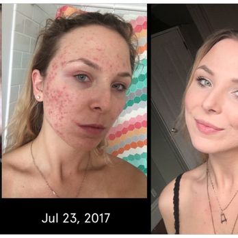 Skin Revision Technologies - Skin Care Near Me - Mesa, Arizona
