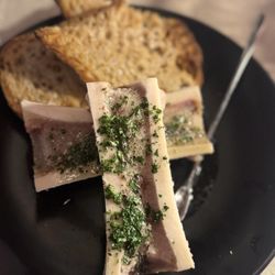 Fig 313 - Bone marrow