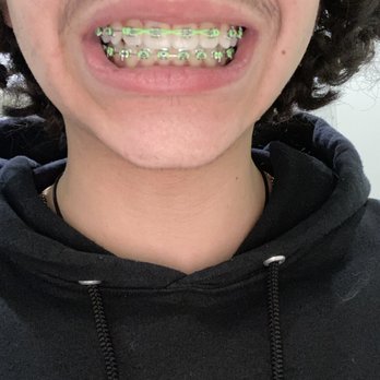 Zara Dental - Happy teeth - General Dentistry Near Me - Houston, Texas Zara Dental - Happy teeth - General Dentistry Near Me - Houston, Texas