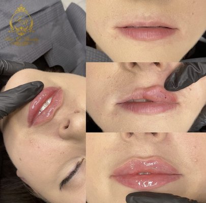 Face Of Beauty by null