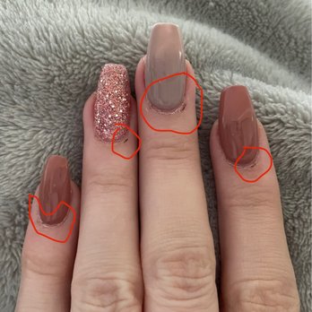 Gaia Nails - Small scabs from nicked cuticles during manicure. - Nail Salons Near Me - Walnut Creek, California