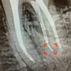 Yoshida Elmer, DDS