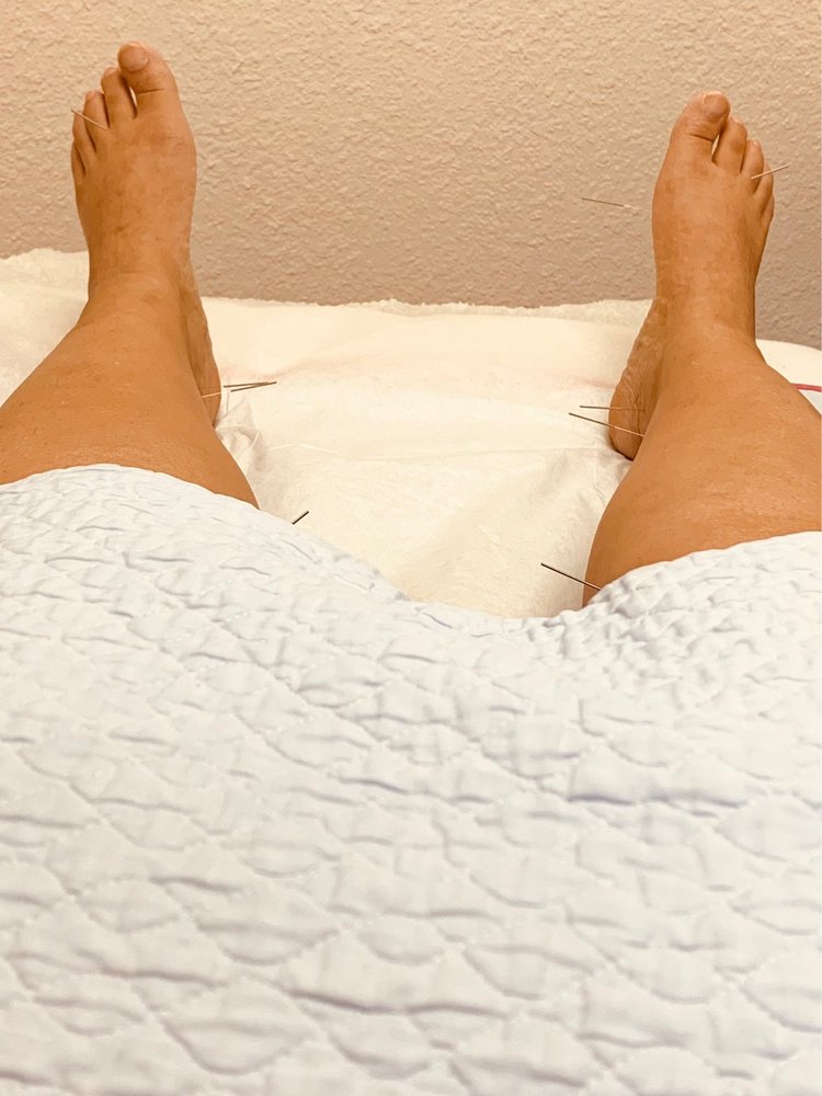 JOY HEALTH ACUPUNCTURE Updated August 2024 14 Photos & 12 Reviews