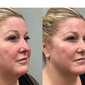 Del Mar Aesthetic Clinic - Laser Hair Removal Near Me - Del Mar, California