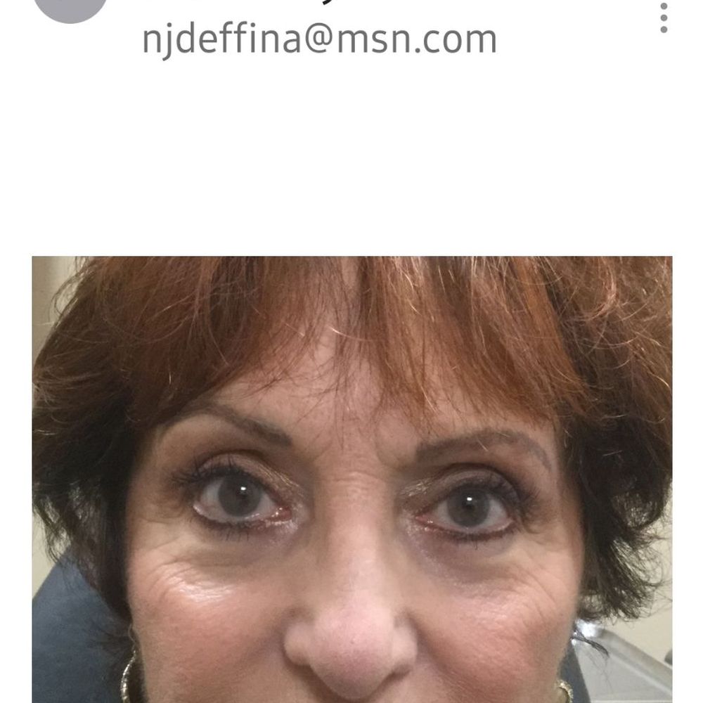 Jason Sabet-Peyman, MD - Before & after!! - Plastic Surgeons Near Me - Fullerton, California Jason Sabet-Peyman, MD - Before & after!! - Plastic Surgeons Near Me - Fullerton, California