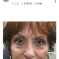Jason Sabet-Peyman, MD - Before & after!!