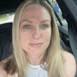 3 days post micro-needling! 3 days post micro-needling!