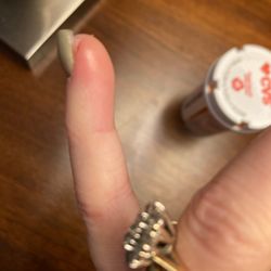 Nails For You - Cut on finger