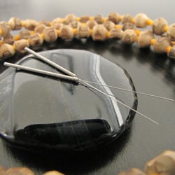 Windstone Acupuncture - Windstone Acupuncture