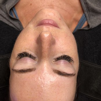 Skintrigue - The glow immediately after a hydrafacial treatment - Eyelash Service Near Me - Las Vegas, Nevada Skintrigue - The glow immediately after a hydrafacial treatment - Eyelash Service Near Me - Las Vegas, Nevada